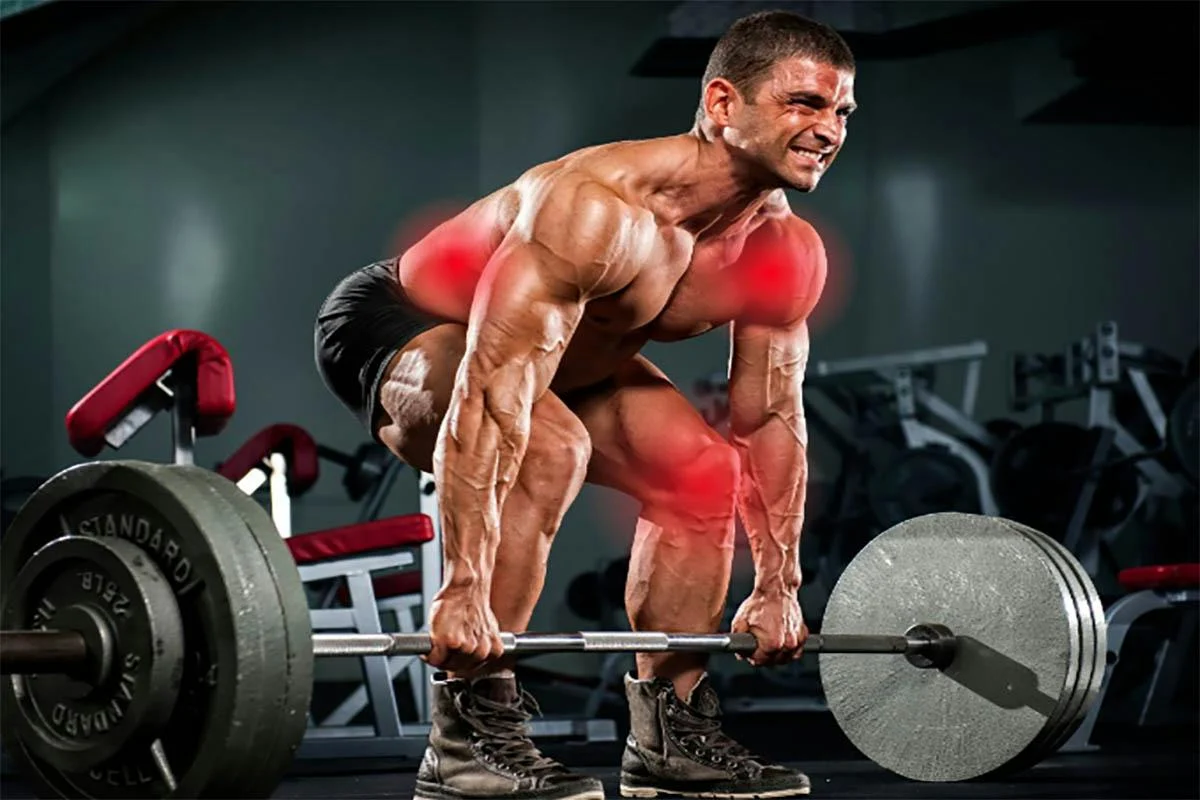 Can Lifting Heavy Weights Above Your Shoulders Cause etd Tendonitis?